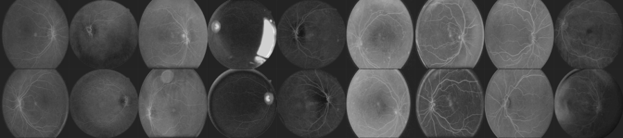 Pairs of fundus images of the eye after the first layer in the convolutional neural network.